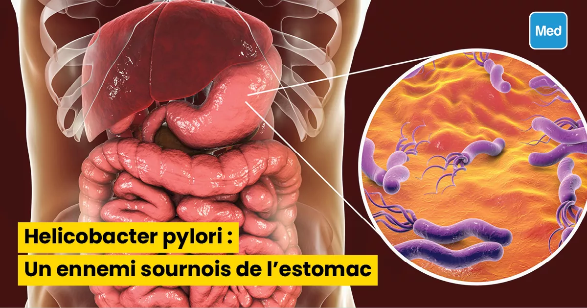 Helicobacter pylori : Un ennemi sournois de l'estomac